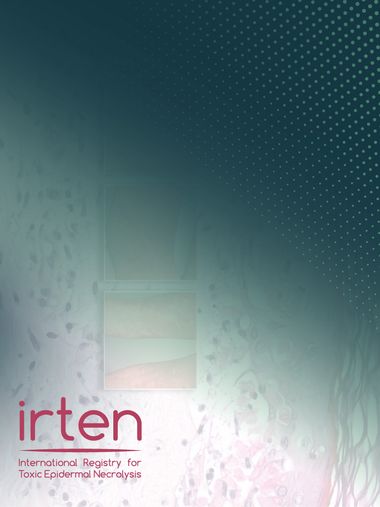 irten slider website